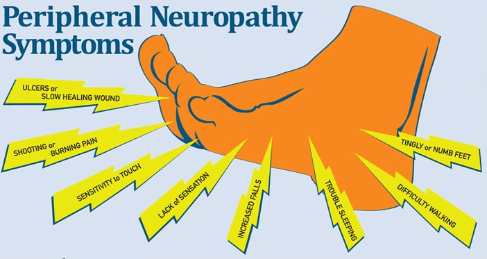 Nursing Diagnosis For Peripheral Neuropathy